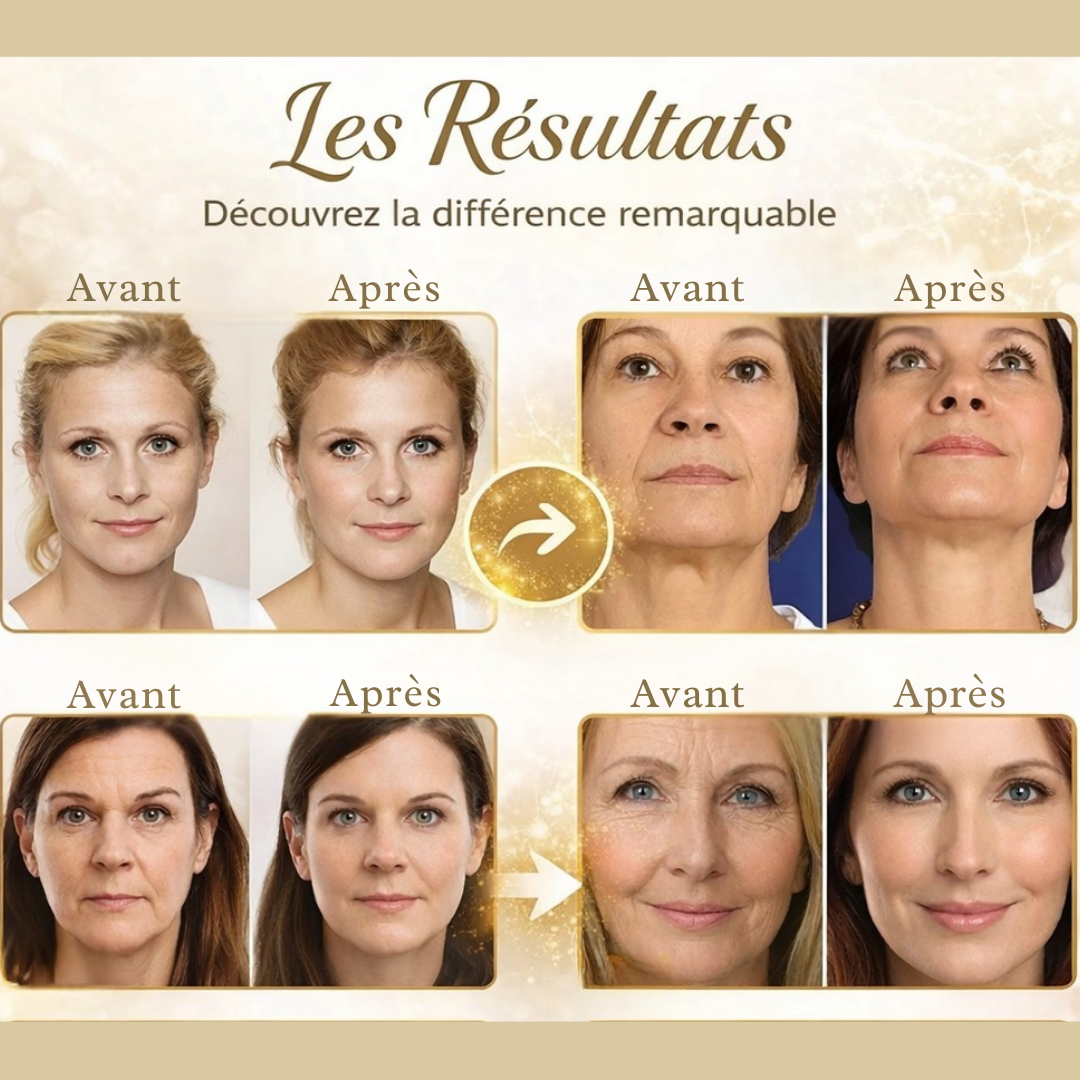 ✔️ Fils de Collagène Éclat – Soin Visage